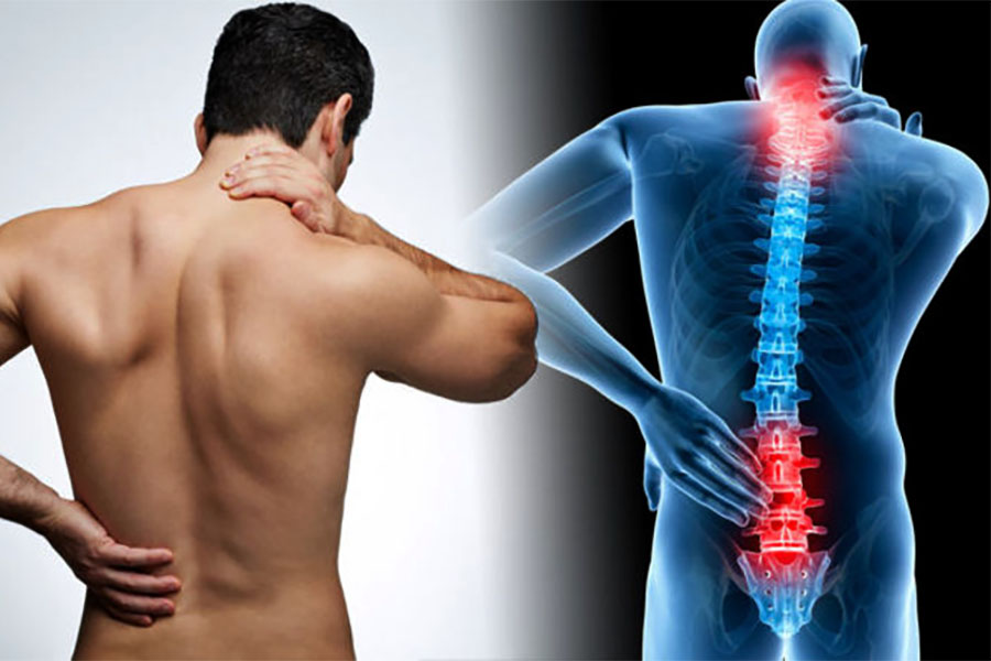 prevenire il mal di schiena
